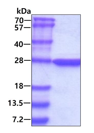 3 μg by SDS-PAGE under reducing condition and visualized by coomassie blue stain.